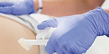 Cavilon Advance Huidbeschermer gebruikt bij een patiënt
