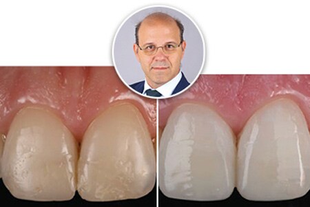 klinische casus thumbnail
