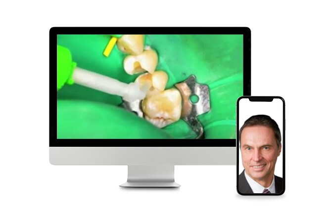 Webinar over cementeren en bonding van tandheelkundige materialen.
