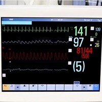 ECG-bewakingsalarmen