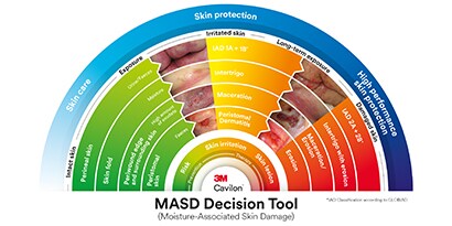 Afbeelding die toont hoe de MASD tool werkt
