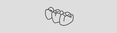 Pictogram met indirecte restauratieoplossingen
