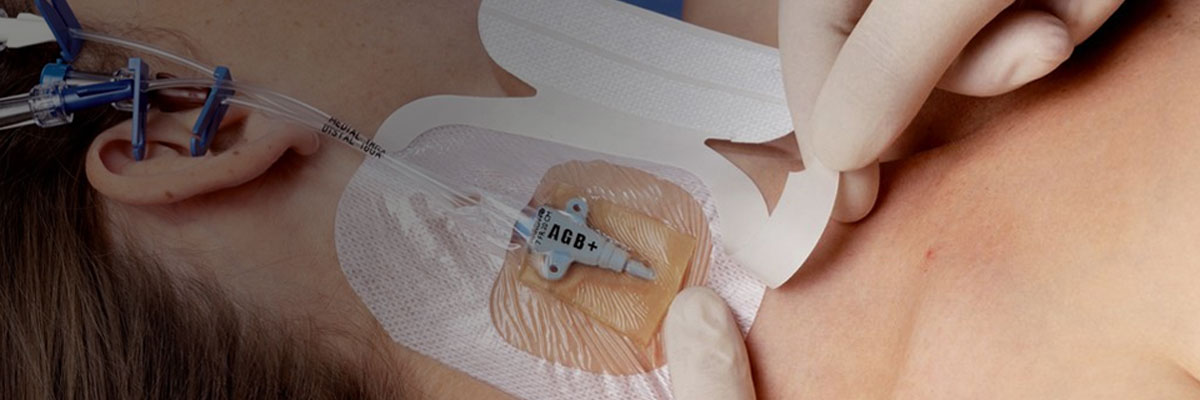 3M™ Tegaderm™ CHG IV-verband
