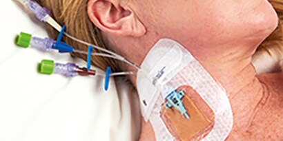Nationale Evidence based richtlijnen voor het voorkomen van aan gezondheidszorg gerelateerde infecties (HAI's)
