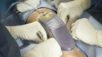 Antibacteriële incisiefolies in de operatiekamer